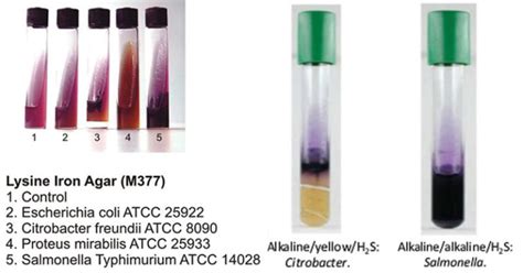 Lysine Iron Agar (LIA): Principle, Composition, .